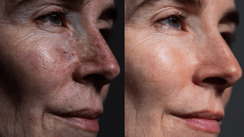 A comparison photo showing a face under low CRI vs high CRI light